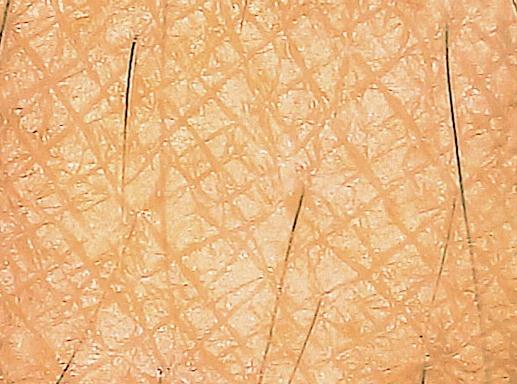 PIEL GRASA Características Apariencia brillosa Poros abiertos Presenta desórdenes de la piel como puntos negros, relieve irregular, poros dilatados.