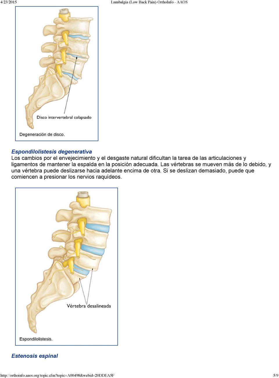 articulaciones y ligamentos de mantener la espalda en la posición adecuada.