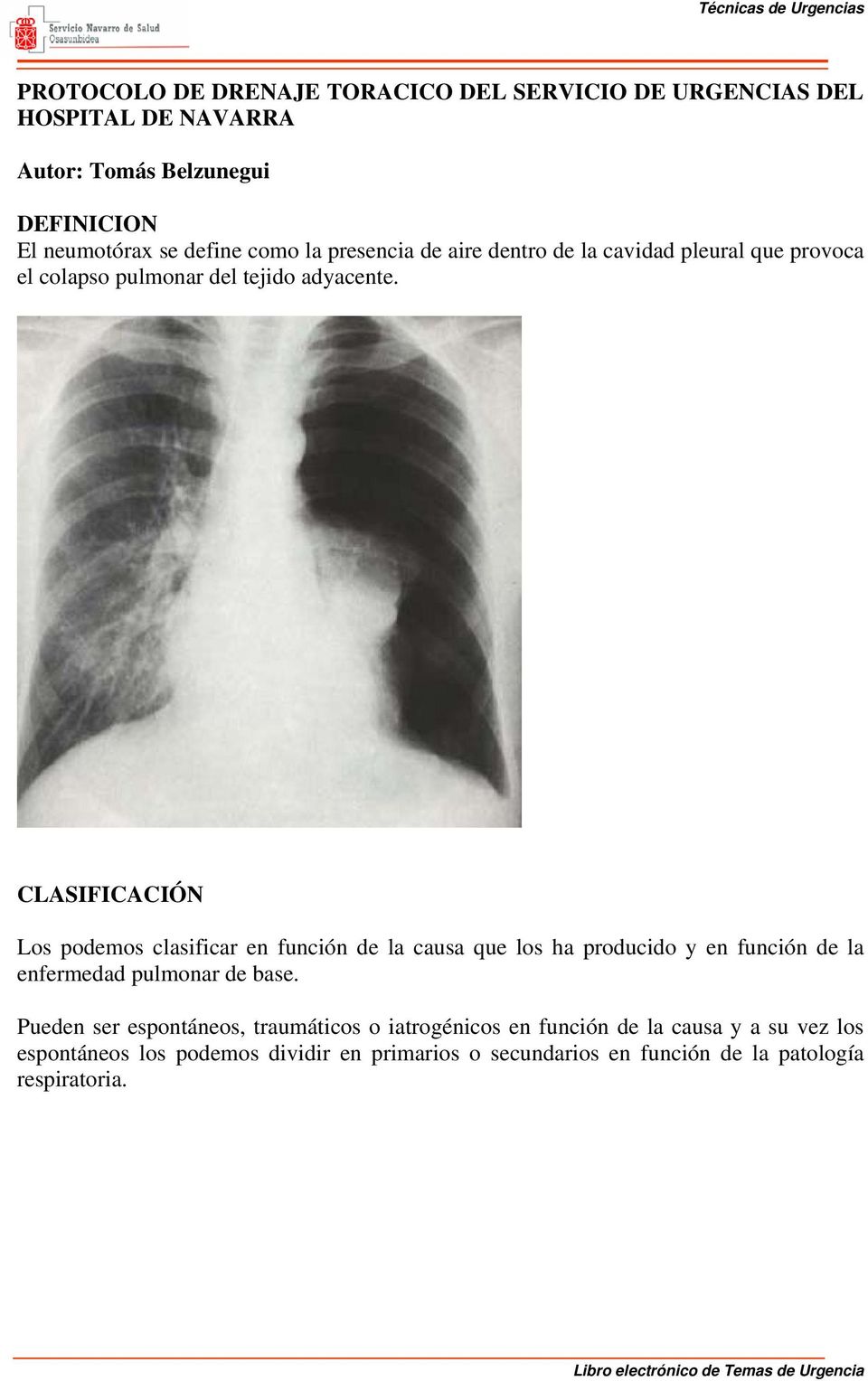 CLASIFICACIÓN Los podemos clasificar en función de la causa que los ha producido y en función de la enfermedad pulmonar de base.