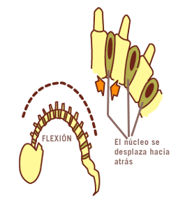 Anatomía fisiológica de la espalda Función del disco intervertebral Amortiguar el peso y repartirlo uniformemente La presión vertical ejercida sobre la columna vertebral se transmite de una vértebra