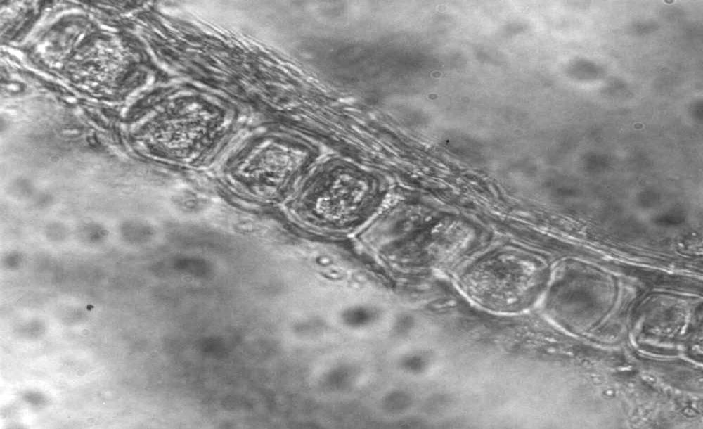 Semilla de. 3- Capa de aleurona En un corte transversal de pericarpo de cariopsis de Avena sp.