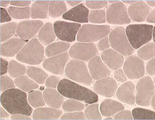 sarcómero Rasgos centrales Corta longitud En fibras tipo 1 & 2 Bordes pobremente