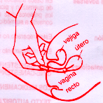 Empujar el émbolo A hasta el tope, con lo que el comprimido queda depositado en el fondo de la vagina. Retirar el aplicador.