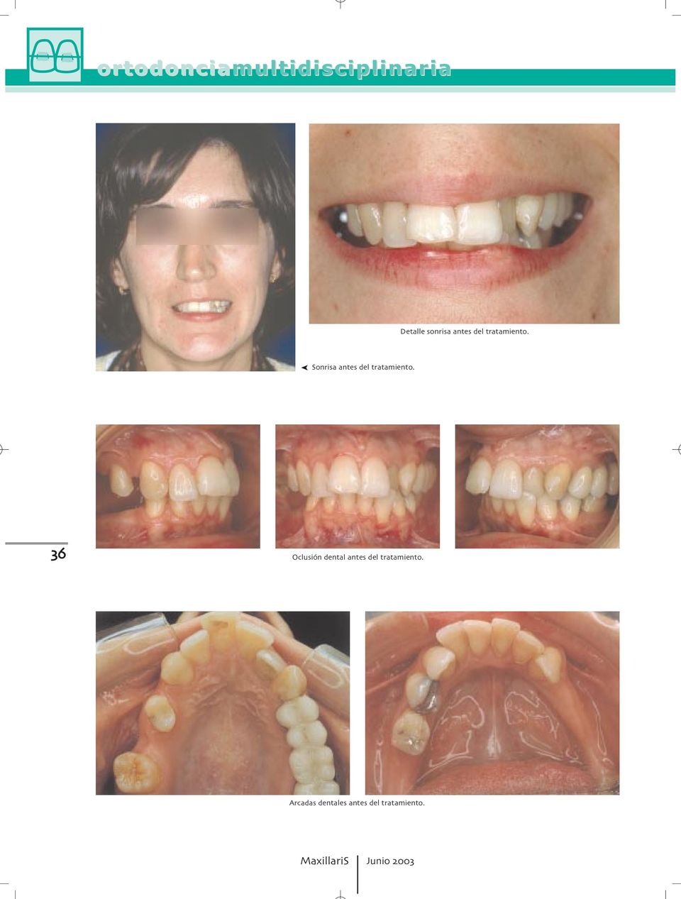 Sonrisa  Oclusión dental  Arcadas dentales 