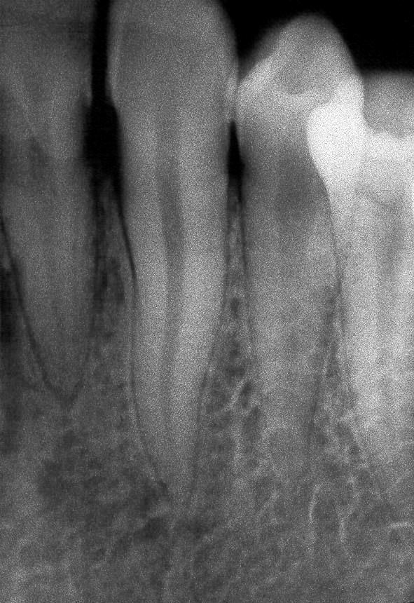 Estructuras dentarias y de Esmalte soporte Dentina Espacio del
