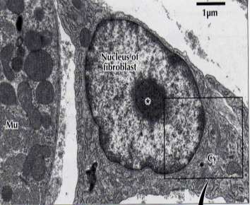 Tejido Conectivo Células MET Núcleo eucromático con parches heterocromáticos pegado a la membrana nuclear y con