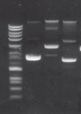 ESQUEMA GENERAL SESIÓN I: TRANSFORMAR cepas de E. coli con un plásmido.