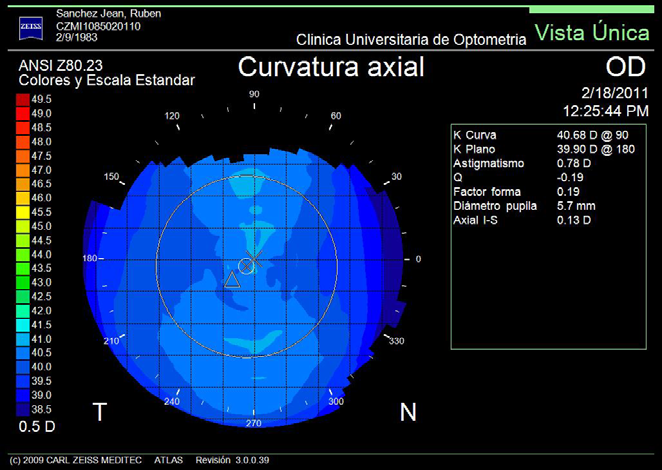 Mapa Axial (sagital) Mide la curvatura en un cierto punto de la superficie corneal en una dirección axial con