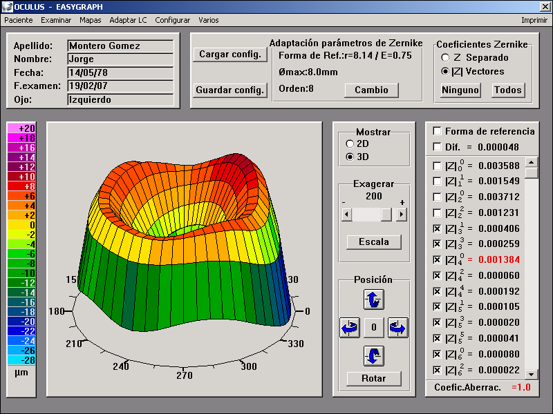 Mapa Aberraciones/Zernike Aporta el frente de onda o bien los índices de Zernike de la superficie anterior. No es la aberración total del ojo.