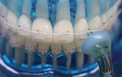 estéticos de nuestros pacientes como las necesidades del ortodoncista.
