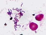Inclusiones citoplasmáticas Gránulos metacromáticos (volutina) Corynebacterium sp