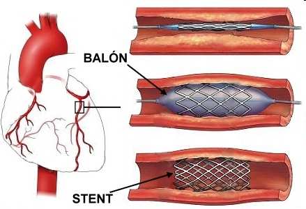 Circuito general o mayor Este circuito conecta el corazón con el resto de los órganos a los que tiene que hacer llegar la sangre.