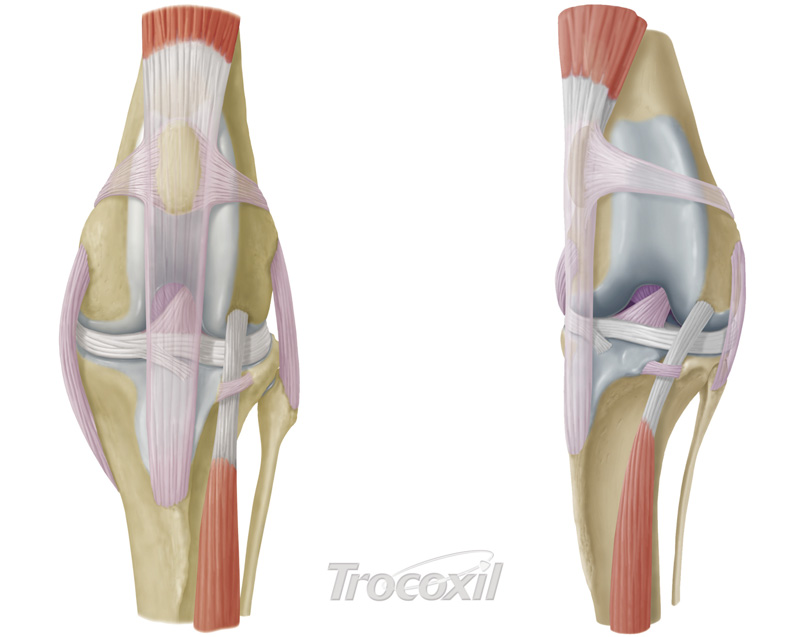 Vista craneocaudal de una rodilla normal en la que se aprecian los ligamentos, menisco y rótula Vista craneocaudal de una rodilla con luxación medial de rótula Rótula