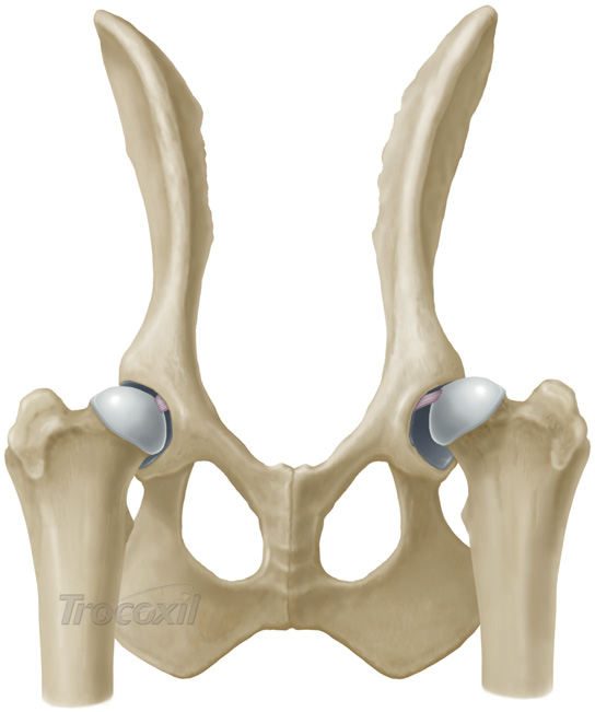 Vista ventrodorsal de una cadera normal derecha Vista ventrodorsal de una cadera
