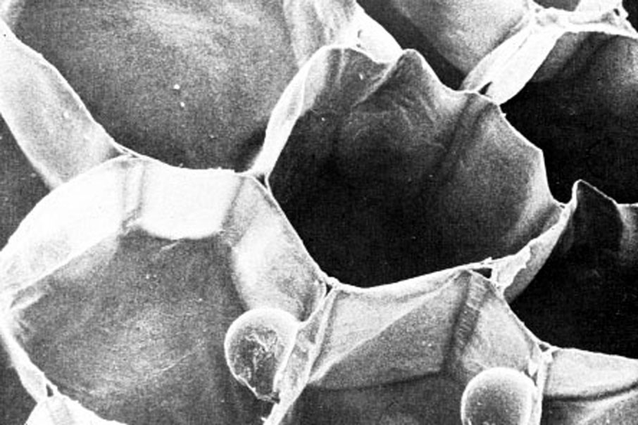 Esta es una micrografía electrónica de rastreo de varias células vegetales. En algunas de ellas se ve el núcleo; pero aparte de este organelo, parecen estar huecas.