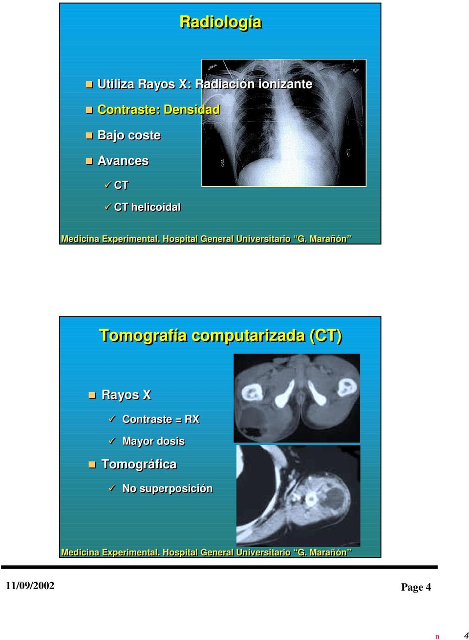 helicoidal Tomografía computarizada (CT) Rayos X