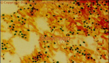 Spore stain preparation A 48-hr-old culture of a large sporeforming