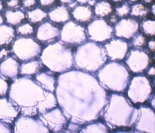 poco diferenciadas y bajo determinadas condiciones pueden desdiferenciarse, recuperando la características de células meristemáticas. Las características citológicas son las siguientes (Fig.
