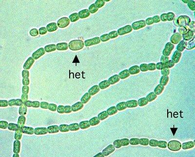 Nostoc: cianobacteria fijadora de nitrogeno, mostrando su tricoma y sus heterocistos.