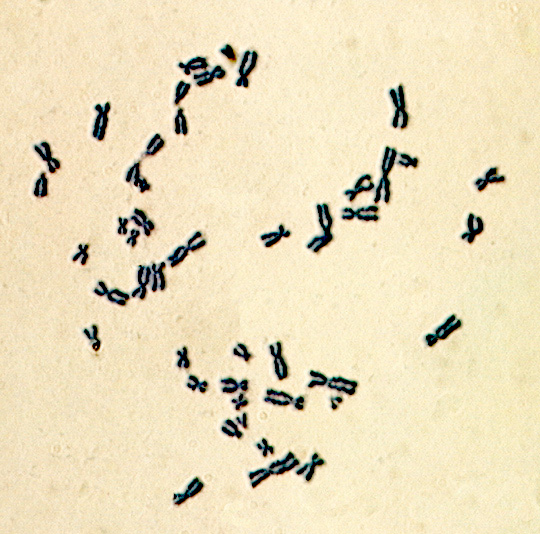 Cada especie tiene un número característico de cromosomas. Células de humanos tienen un número diploide (2n), es decir, tienen dos copias de cada uno de los 23 cromosomas.