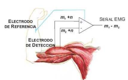 La captación de las señales eléctricas producidas por los músculos durante una contracción muscular se conoce como electromiografía.