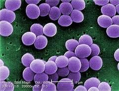 Evolución de la resistencia en Staphyloccocus aureus BlaZ Staphylococcus aureus MRSA Bacteria