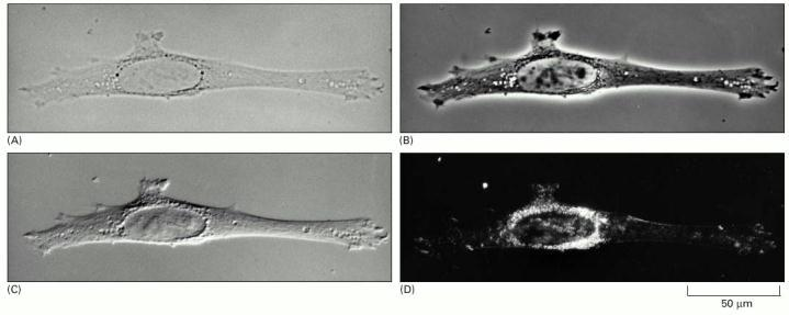 Fibroblastos observados con distintos tipos de Microscopios A: Microscopia de Campo Claro
