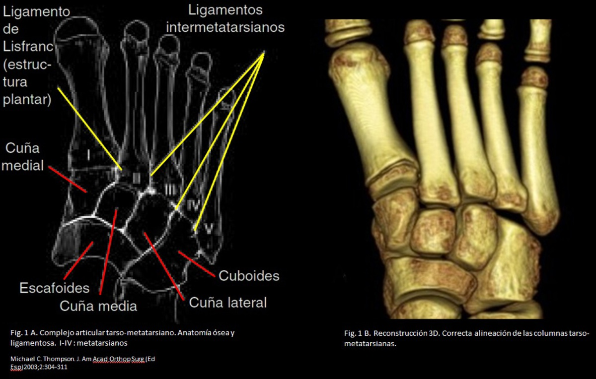 Las cuñas medial, intermedia y lateral (ò 1º, 2º y 3º) articulan distalmente con los metatarsianos primero, segundo y tercero, respectivamente La siguiente figura ilustra los elementos óseos y