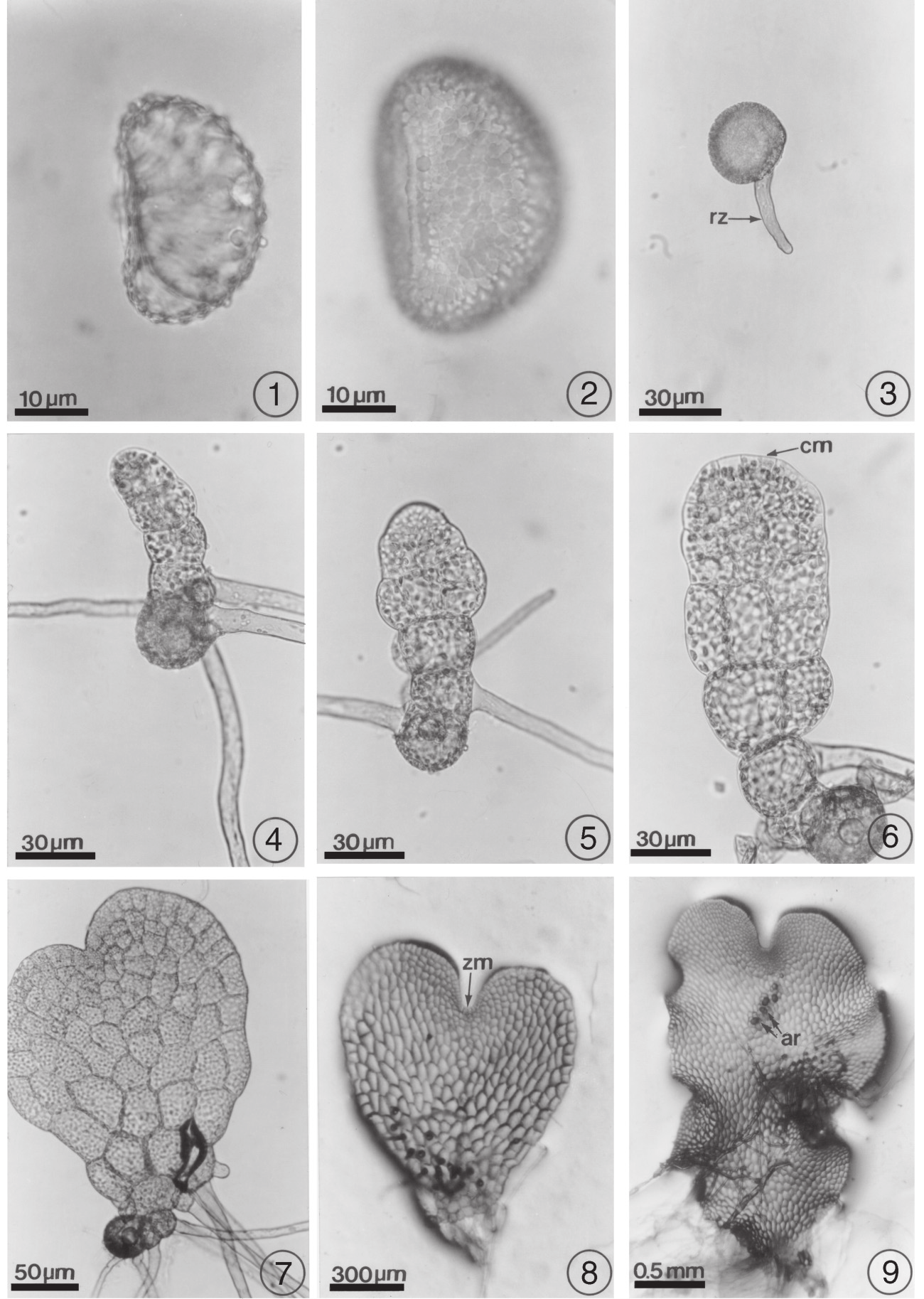 Figs.1-9. Morfología de los gametofitos de Microgramma lycopodioides y Microgramma piloselloides. 1. Espora de M. lycopodioides; 2. espora de M. piloselloides; 3. germinación, M.