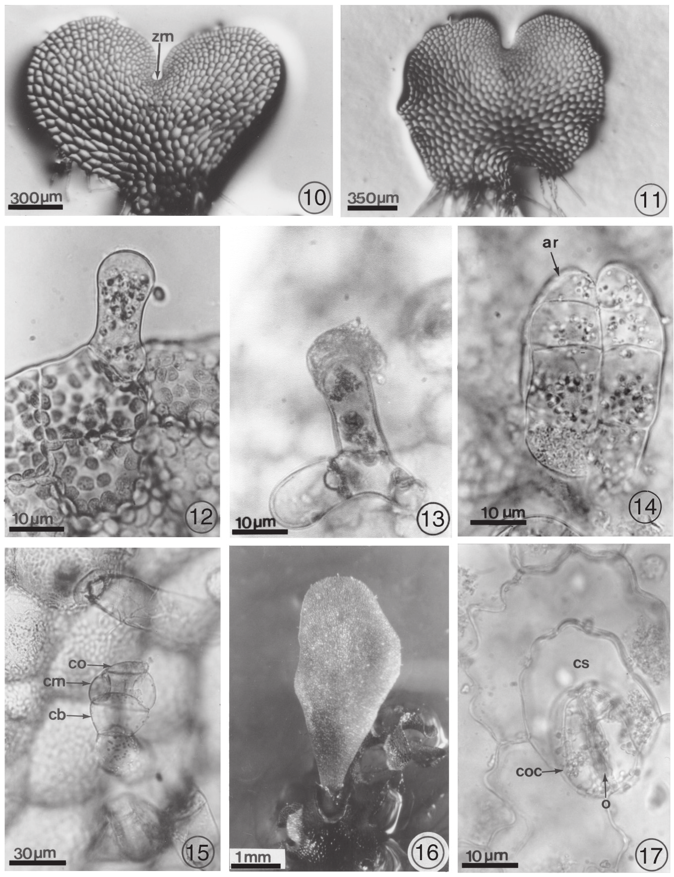Figs. 10-17. Morfología de los gametofitos de Microgramma lycopodioides y Microgramma piloselloides. 10. gametofito cordiforme, M. lycopodioides (67 días); 11. gametofito cordiforme, M. piloselloides (60 días); 12.