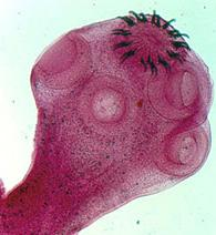 La cisticercosis humana es generada cuando un humano consume los huevos de la T.Solium que fueron eliminados de las heces fecales del humano (Dra.