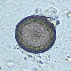 Los huevecillos de Taenia solium miden unos 30 µm y son esféricos, están cubiertos por la membrana de la oncosfera y el embrióforo, lo que les confiere gran resistencia (Dra. Uribarren T, 2014b).