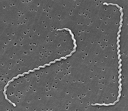 Agente etiológico Bacterias espiraladas finamente enrolladas. Extremos en forma de ganchos.