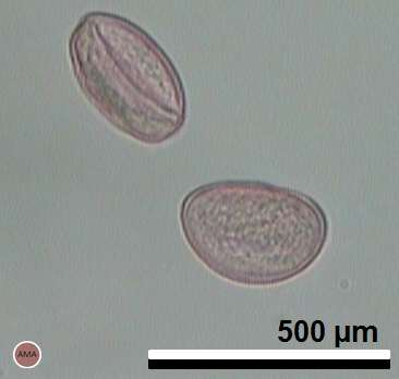 En la microspora o grano de polen de pino (Gimnospermas), la exina se dilata formando dos sacos aeríferos, la intina rodea a la célula vegetativa, a la célula generativa y a dos células protálicas,