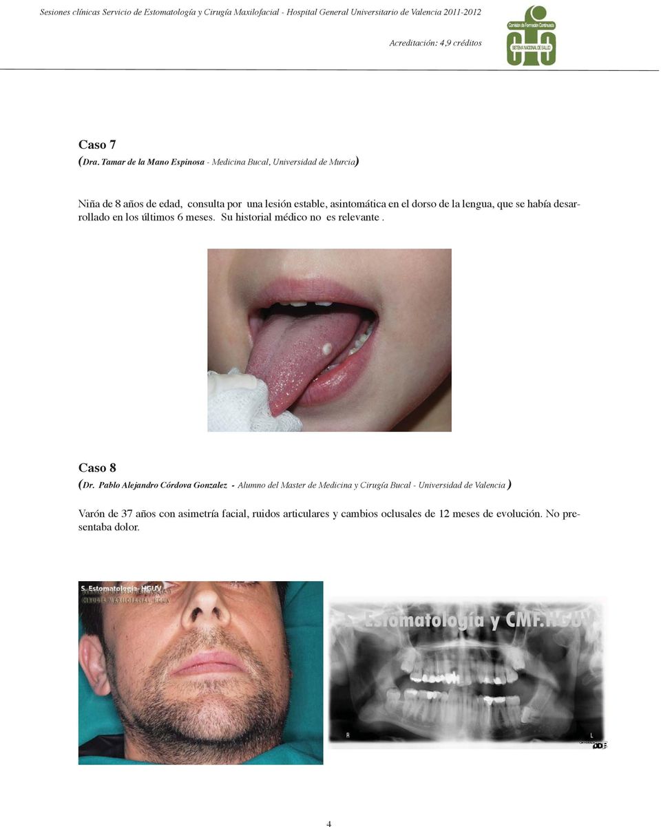 asintomática en el dorso de la lengua, que se había desarrollado en los últimos 6 meses. Su historial médico no es relevante.