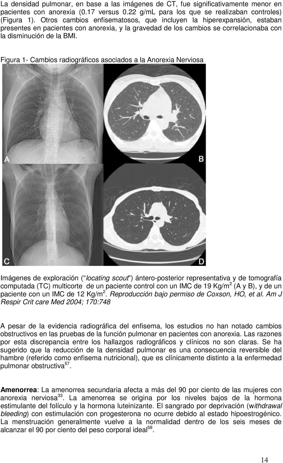 Figura 1- Cambios radiográficos asociados a la Anorexia Nerviosa Imágenes de exploración ( locating scout ) ántero-posterior representativa y de tomografía computada (TC) multicorte de un paciente