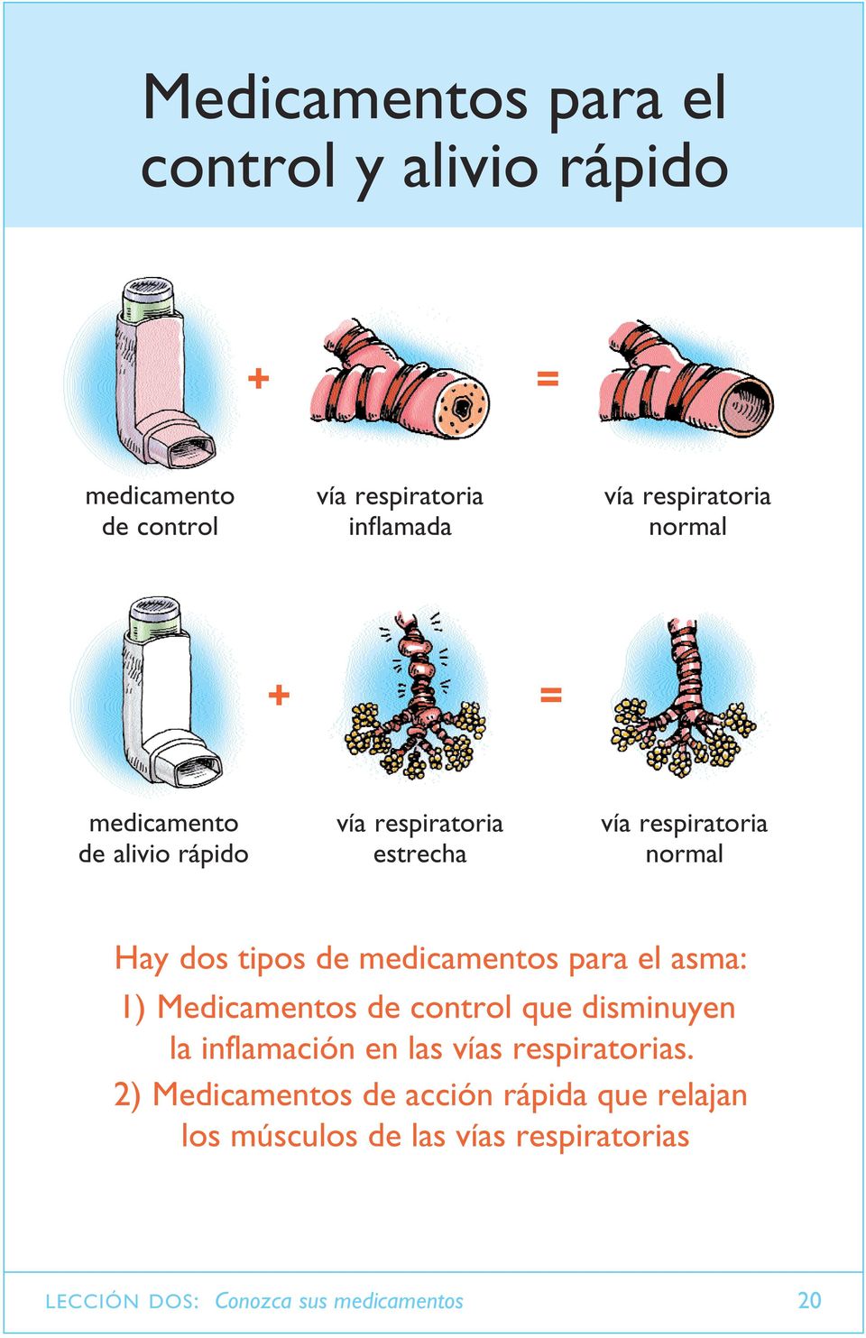 tipos de medicamentos para el asma: 1) Medicamentos de control que disminuyen la inflamación en las vías