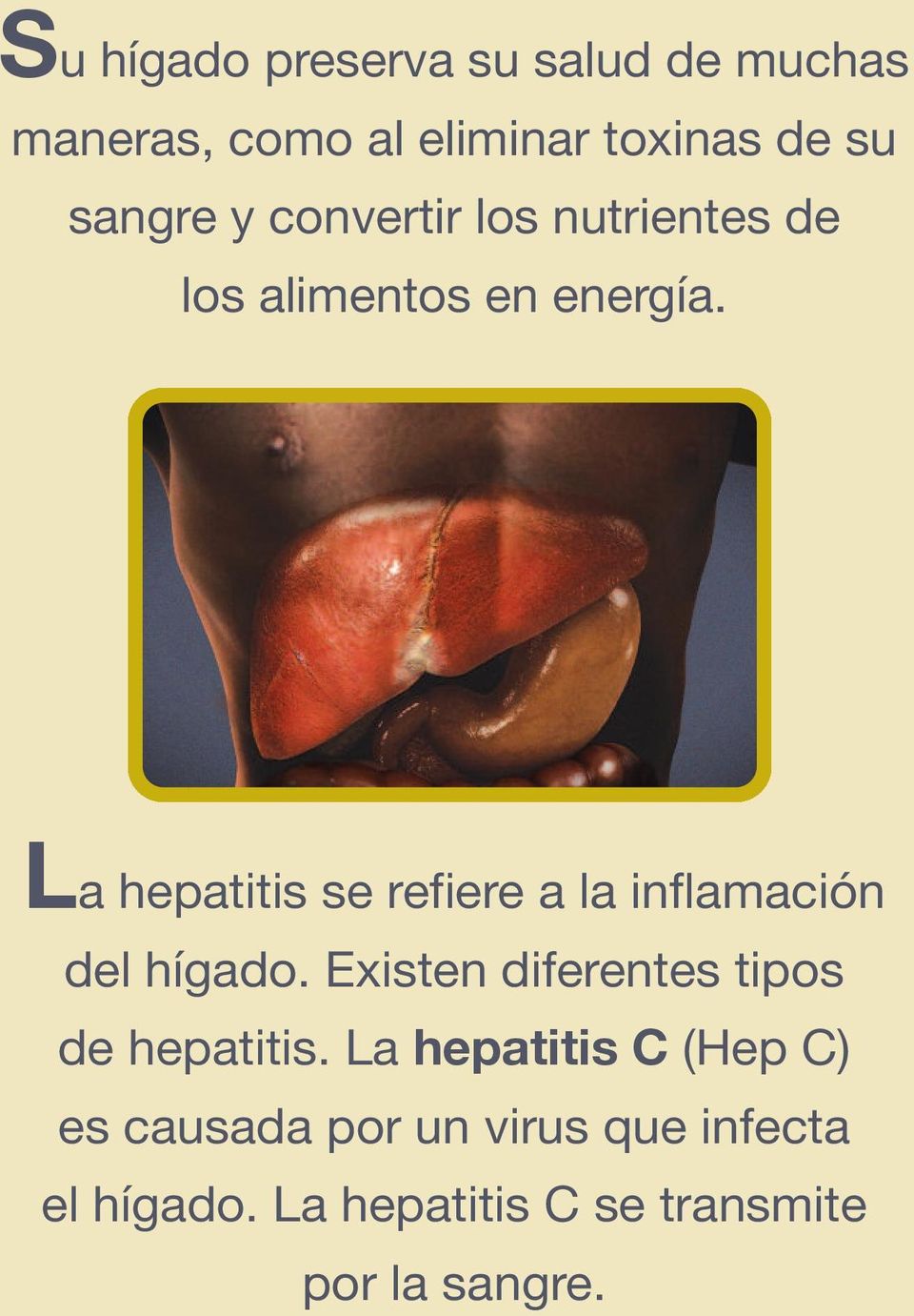 La hepatitis se refiere a la inflamación del hígado.