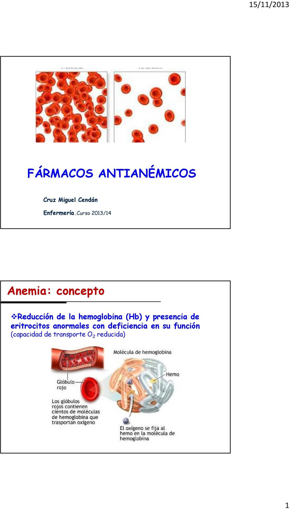 hemoglobina (Hb) y presencia de eritrocitos anormales