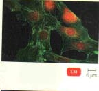 Tipo de microscopio Caracteristicas Imagen Usos principales Fluorescencia Usa como fuente de iluminación luz ultravioleta dando color fluorescente(rojo,verde,amarillo, azul) al especímen y emite luz