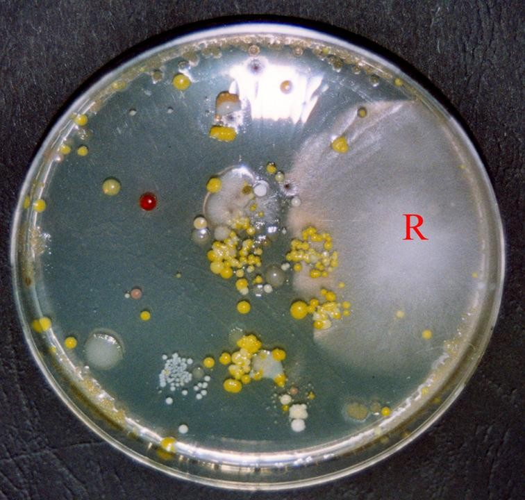 J.P. LÓPEZ-PÉREZ Figura 5.- Colonias de microorganismos viables heterótrofos en agar nutritivo antes de lavarse las manos.