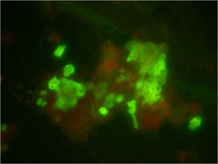 Inmunofluorescencia Directa Fundamento Anticuerpos monoclonales contra antígenos de