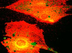 primarios y secundarios. Homeostasis del calcio intracelular y técnicas de imagen para observar calcio citosólico in vivo en tiempo real.