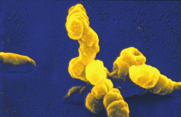 Bacteria Infecciones por Haemophilus