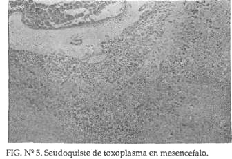 282 REVISTA MEDICA HONDUREÑA. VOL. 56-1988 BIBLIOGRAFÍA 1. Brooki, R.G. et al "Detection oftoxoplasma gondii antigens by a dot-inmunobinding technique" j. Clin Micorbial. 1985. JAN, 21 (1): 113-6. 2. Desmonts, G.