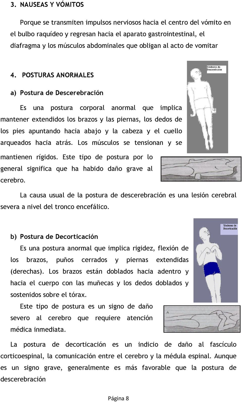 POSTURAS ANORMALES a) Postura de Descerebración Es una postura corporal anormal que implica mantener extendidos los brazos y las piernas, los dedos de los pies apuntando hacia abajo y la cabeza y el
