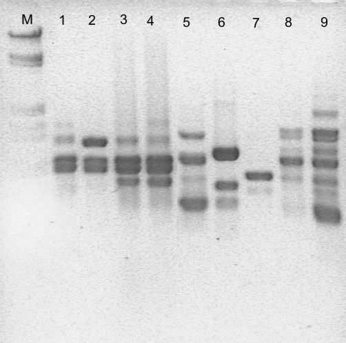 PCR-fingerprinting Fusarium 21226 5000 4900 2000 1500 1300 947 831 PCR-fingerprinting de 9 especies de Fusarium