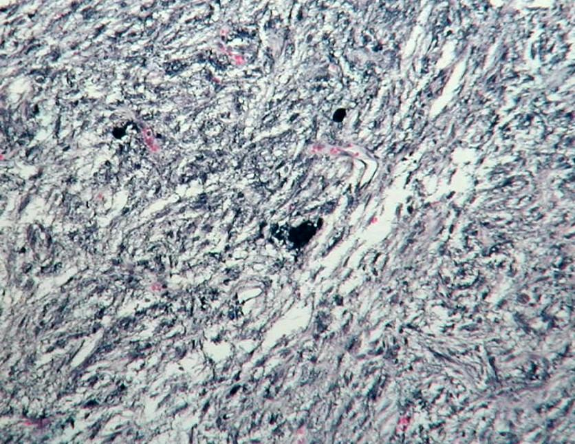 Las neurosecreciones que provienen del hipotálamo, se agrupan formando estructuras irregulares, basófilas conocidas como cuerpos de Herring.
