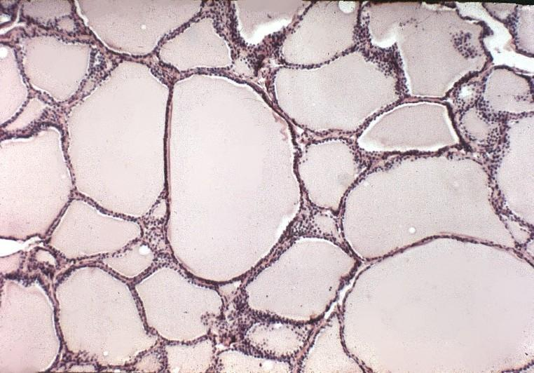 Esta es otra imagen de los folículos de la glándula tiroides. Note que se encuentran estrechamente relacionados entre sí.