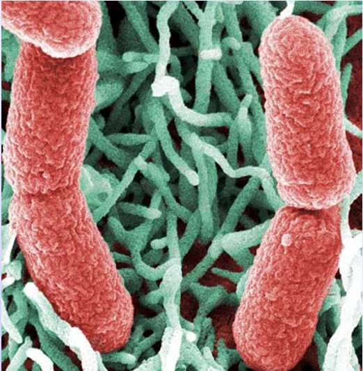 Microorganismos patógenos transmitidos por los alimentos EMERGENTES: Listeria monocytogenes Escherichia